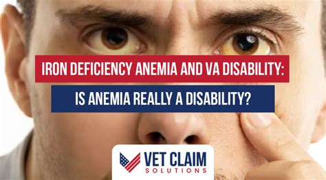 va disability for anemia|Iron Deficiency Anemia and VA Disability: Is Anemia Really a .